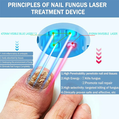 FungiFree Laser Solution